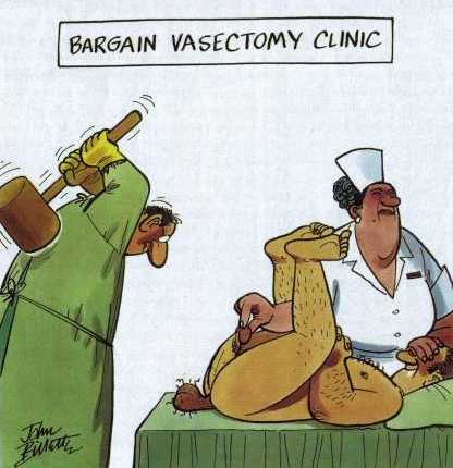 Vasectomy